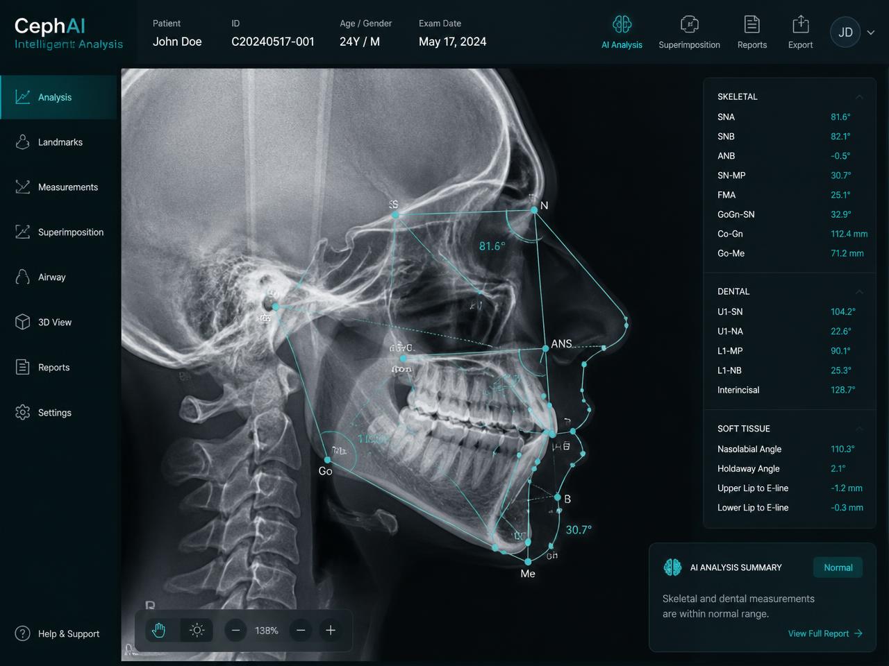 Analyse d'imagerie IA assistée par intelligence artificielle